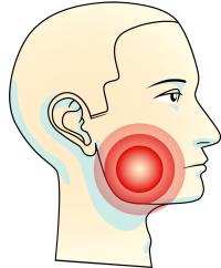 Dental_Web_illustrasjon_smerte_kjeve
