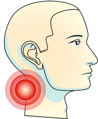 Dental_Web_illustrasjon_smerte_nakke