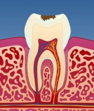Hull_i_tennene_illustrasjon_3