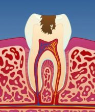 Hull_i_tennene_illustrasjon_4